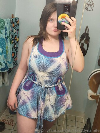 akcherrydynamite Nude Leaks Photo 18