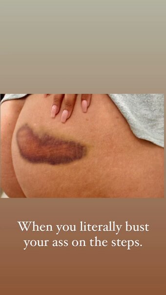 Alexis Fields / alexisfieldspix Nude Leaks Photo 1