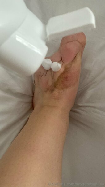 amputationlula Nude Leaks Photo 1