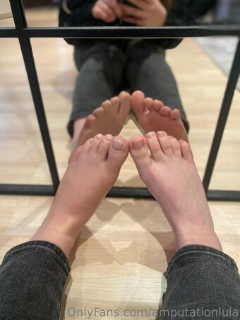 amputationlula