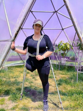 amputeedarling Nude Leaks Photo 10