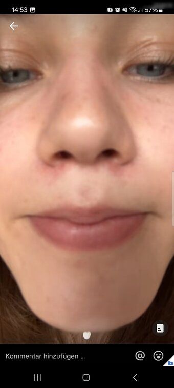 Anna ndc / anna_ndc17 Nude Leaks Photo 26