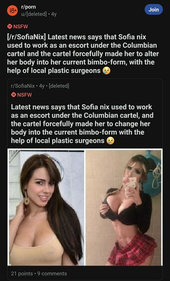 Before and After : Pornstar Boobjobs