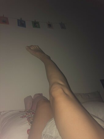 bleedingbubblegum / bleeding.bubblegum Nude Leaks OnlyFans Photo 1