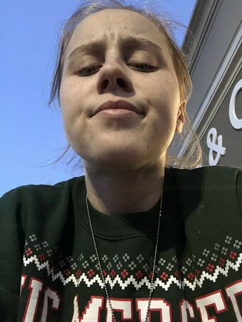 bleedingbubblegum / bleeding.bubblegum Nude Leaks OnlyFans Photo 17