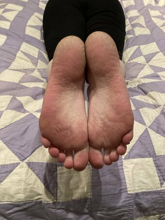 Candytoes Nude Leaks Photo 2