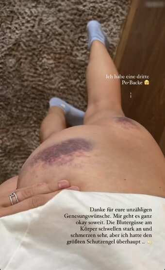 Carmushka Nude Leaks Photo 12