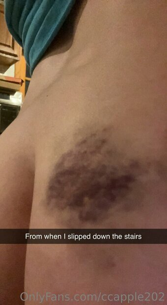 ccapple202 Nude Leaks Photo 6