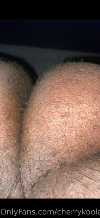 cherrykoolaid Nude Leaks Photo 3