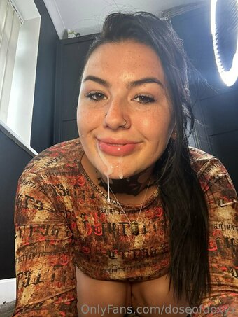 Doseofdoxyx Nude Leaks OnlyFans Photo 7