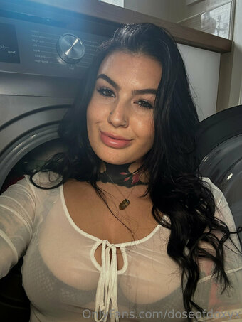 Doseofdoxyx Nude Leaks OnlyFans Photo 20