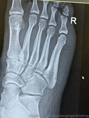 drunkengingerdrinking Nude Leaks Photo 9