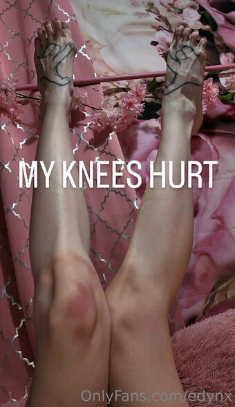 edynx Nude Leaks Photo 6