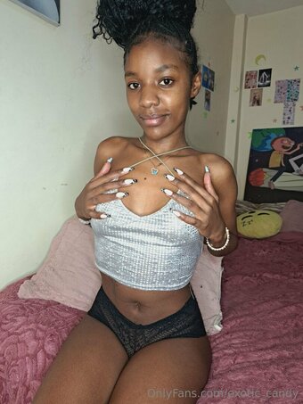 exotic_candy Nude Leaks Photo 11