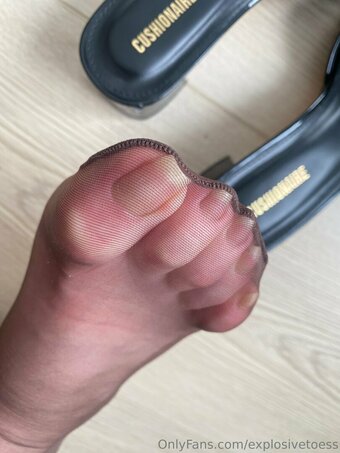 explosivetoess Nude Leaks Photo 20