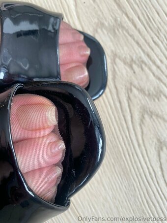 explosivetoess Nude Leaks Photo 21