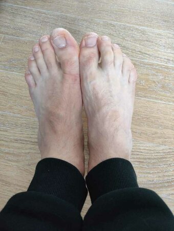 Feetadele Nude Leaks Photo 1