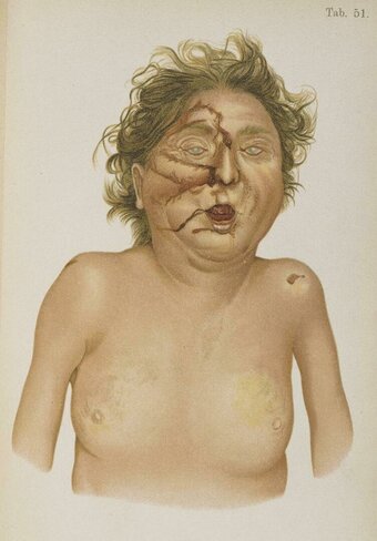 forensic Nude Leaks Photo 1