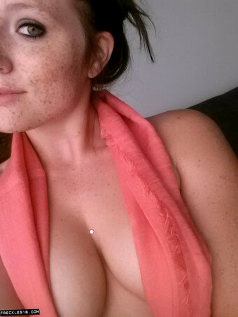 Freckles18 Nude Leaks Photo 18