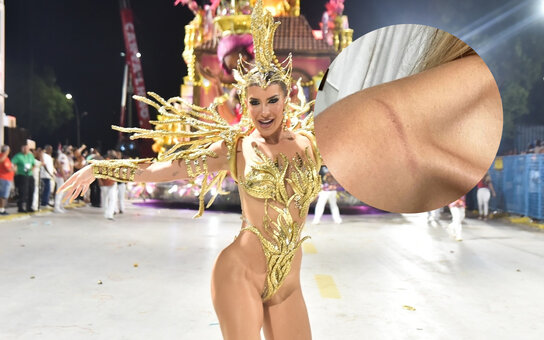 Lore Improta Nude Leaks Photo 1