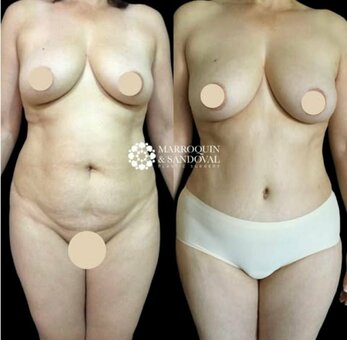 Marroquin Nude Leaks Photo 2