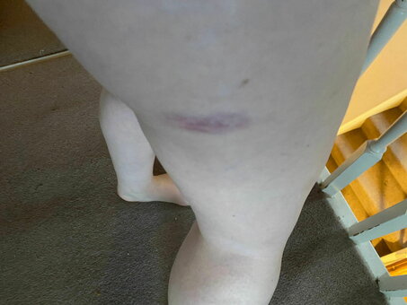 Meemo Comma / meemocomma Nude Leaks Photo 21