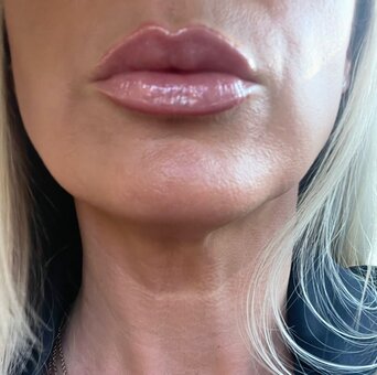 Nipsstrips / nipsatstrips Nude Leaks OnlyFans Photo 4