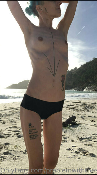 Problemwiththesun / PEOPLEFROMTHELITTLETOWN / problem_with_the_sun / sun_problem Nude Leaks OnlyFans Photo 14