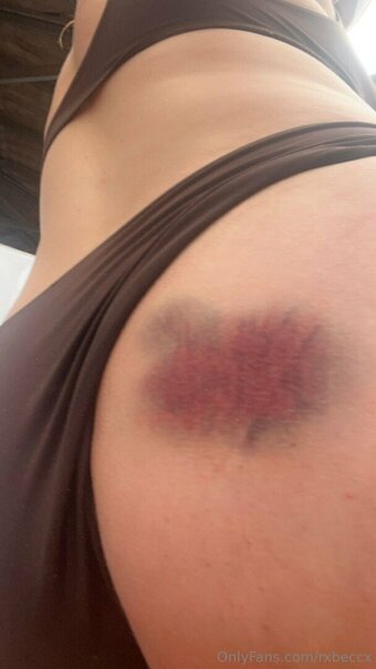 rxbeccx Nude Leaks Photo 5
