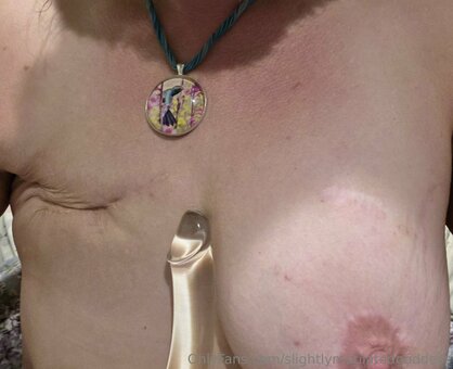 slightlymutilatedgoddess Nude Leaks Photo 8