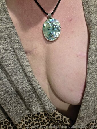 slightlymutilatedgoddess Nude Leaks Photo 14