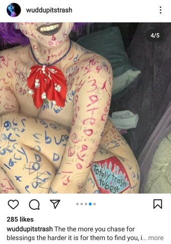 Tottallytrashed / tw0lambs Nude Leaks Photo 1