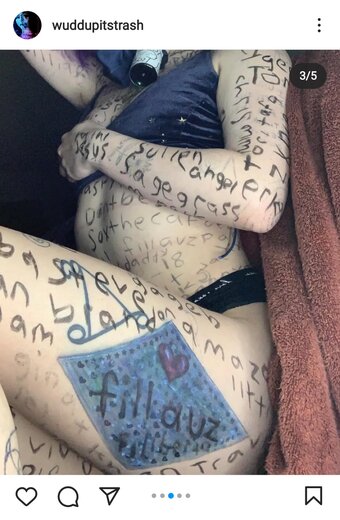 Tottallytrashed / tw0lambs Nude Leaks Photo 4