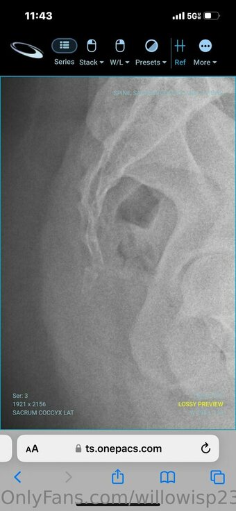 willowisp23 Nude Leaks Photo 8