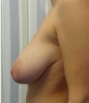 breasts-19.jpg