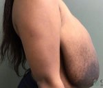 breast-reduction-before-and-yafter-587G4XLlfJhs_highres copy.jpg