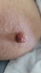 Nipple (6).jpeg